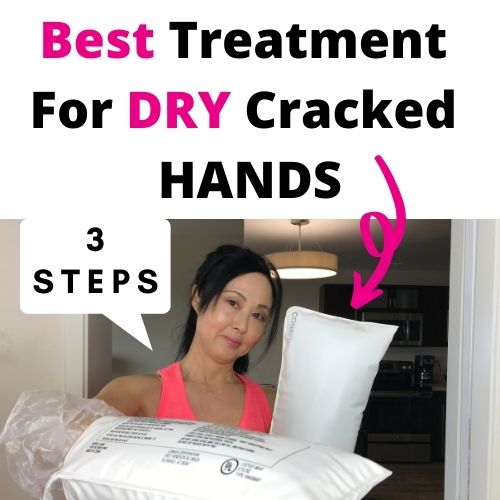 How To Treat Dry Cracked Hands