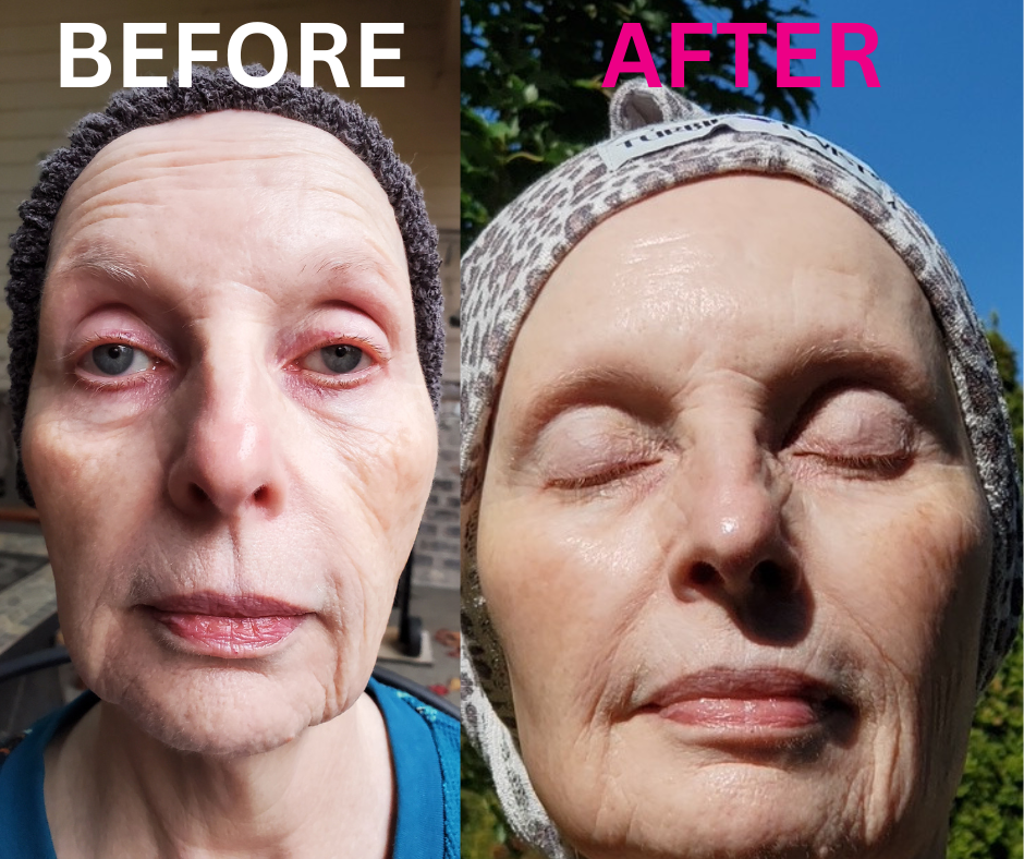 Online Professional Skin Consultation- Anti Aging Treatment Consultation **BRAND NEW - GSC BB