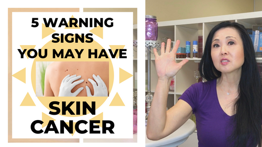 5 Warning Signs Of Skin Cancer