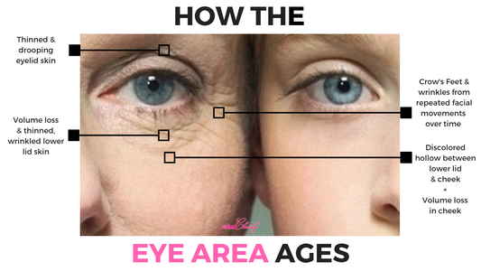 ANTI AGING TIP: How to Treat Dark Circles Around the Eyes, Bags Under Eyes, Saggy Eyelids