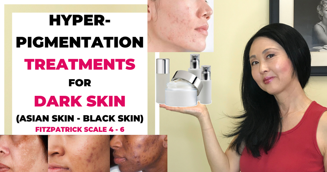 Hyperpigmentation Treatments For Dark Skin: Black Skin Asian Skin And Fitzpatrick 4-6