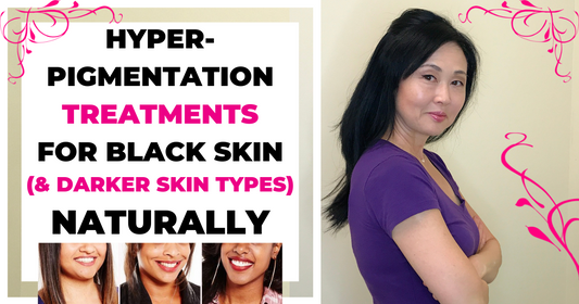 Hyperpigmentation Treatments For Black Skin (And Darker Skin Types)