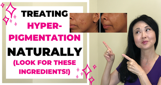 Treating Hyperpigmentation Naturally (Look For These Ingredients)