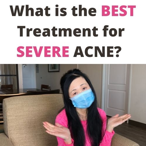 What Is The Best Way To Treat Severe Acne?
